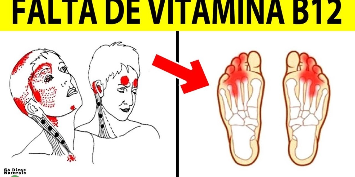 12 preguntas respondidas con respecto a la vitamina B12 Centro de Estudios en Nutrición